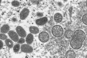 OMS renombrará viruela símica para evitar estigma
