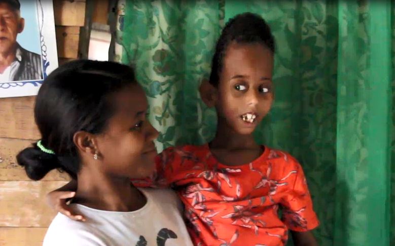 Mujer pide vivienda digna y ayuda para su niño con microcefalia