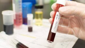Seis nuevos casos de cólera; próxima semana llegará primer lote de vacunas