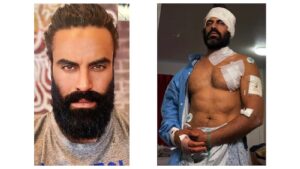 Actor indio atacado a hachazos en un gimnasio de California
