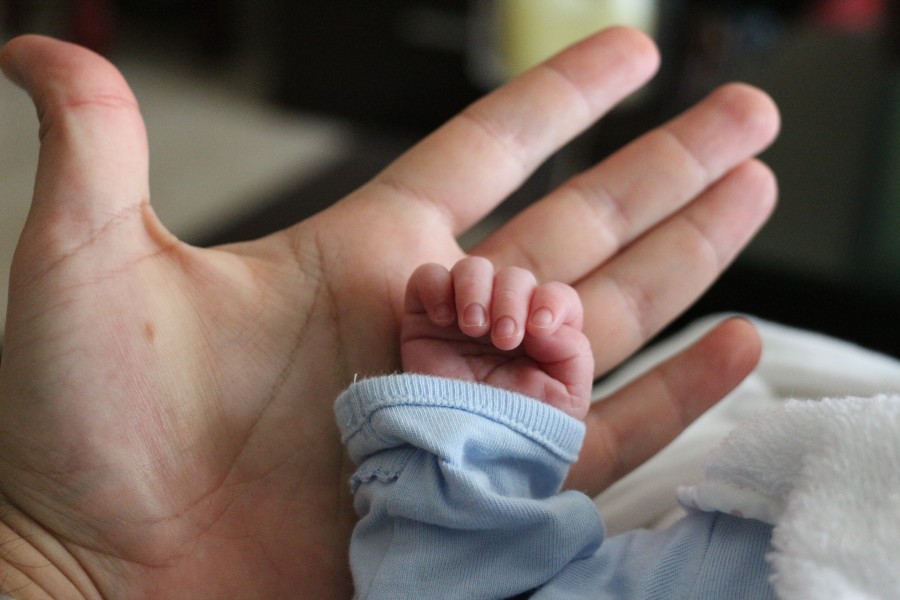 Bebé prematuro nace con un cuerno en lugar de piernas