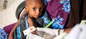 El Niño puede aumentar la malnutrición y las epidemias en Latinoamérica, advierte la OMS