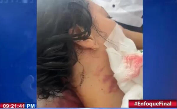 Persiguen hombre hirió a puñaladas a su expareja en Villa Los Almácigos