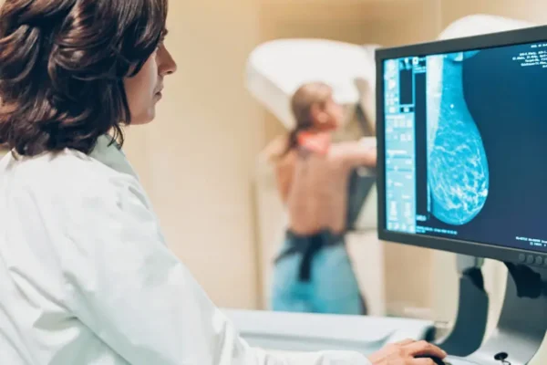 A esta edad las mujeres deben hacerse la primera mamografía