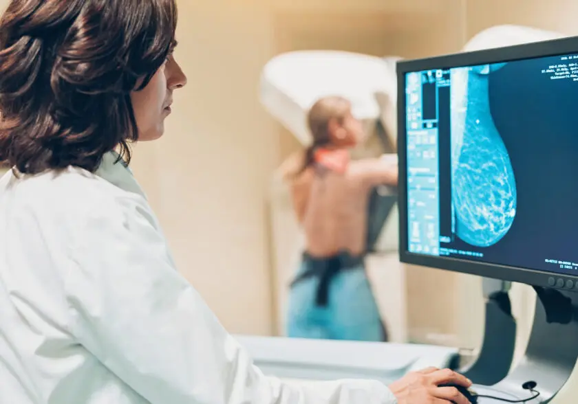 A esta edad las mujeres deben hacerse la primera mamografía