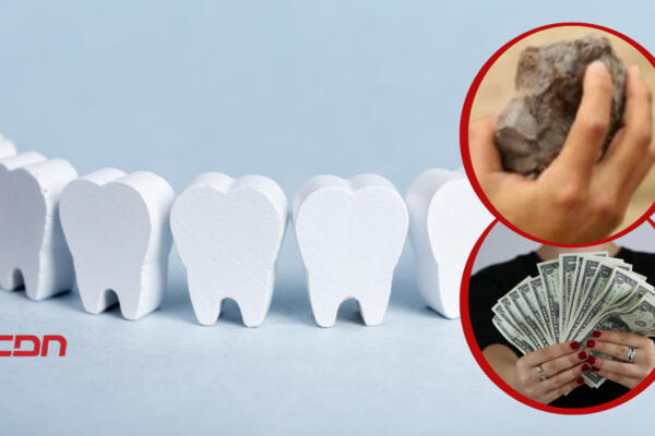 Mujer que perdió seis dientes pide se le pague su dentadura. (Foto: CDN Digital)