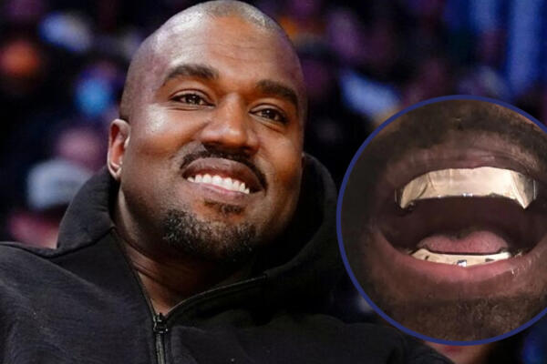 El rapero Kanye West con su dentadura de titanio. Foto: CDN digital. 