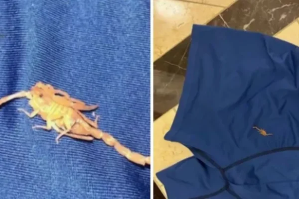 Un escorpión se metió en su ropa interior y lo picó. Foto: Fuente externa