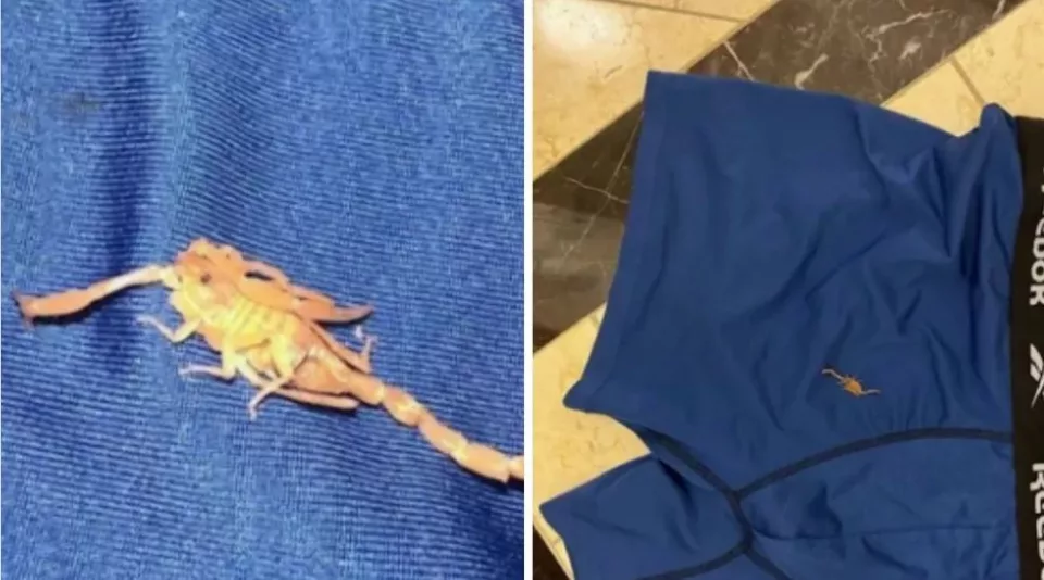Un escorpión se metió en su ropa interior y lo picó. Foto: Fuente externa