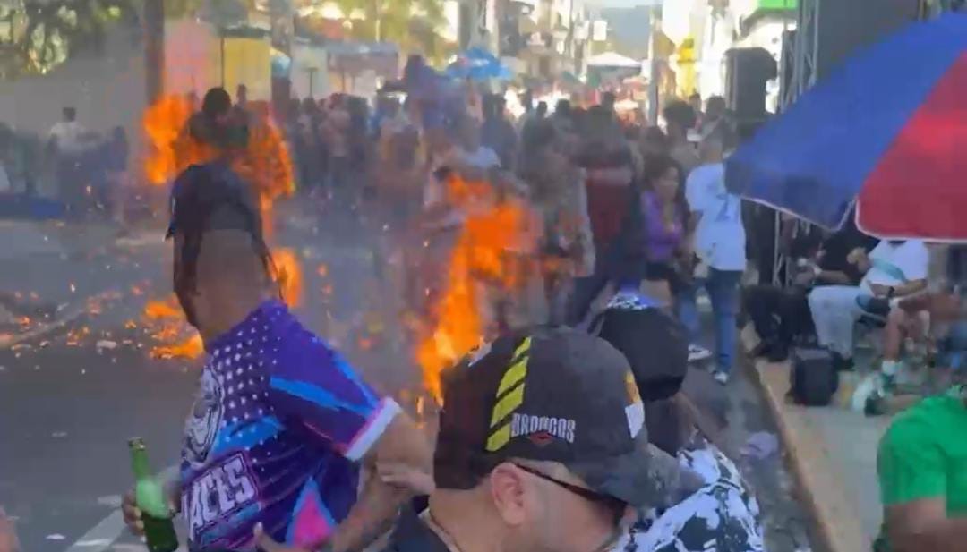 Varios niños quemados por fuegos artificiales en carnaval de Salcedo