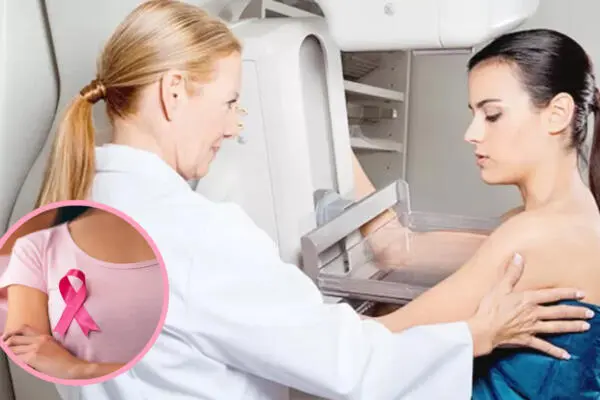 Imagen de referencia a mamografía (Foto: fuente externa)