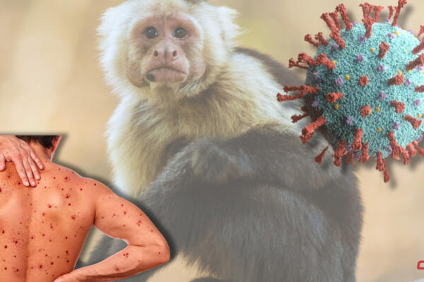Virus de la viruela del mono. Foto: Fuente externa 
