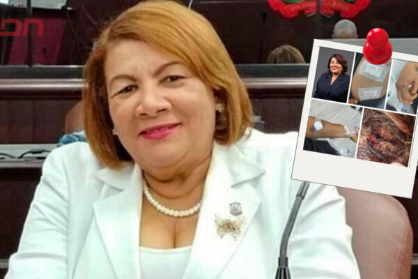 Candidata a diputada Cleo Sánchez fue herida por un extraño dentro de su hogar. Afortunadamente esta fuera de riesgo en estos momentos. Foto: CDN Digital 