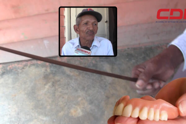 Yoni Morillo Casanova, quien usa su cuchillo como su dentadura. Foto CDN Digital
