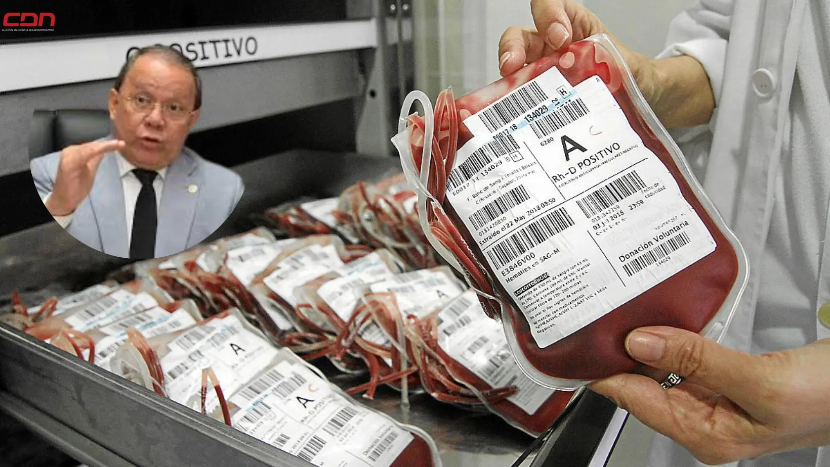 Director de Homocentro Nacional, Pedro Sing, indica, no hay cultura de donación de sangre. (foto, CDN)