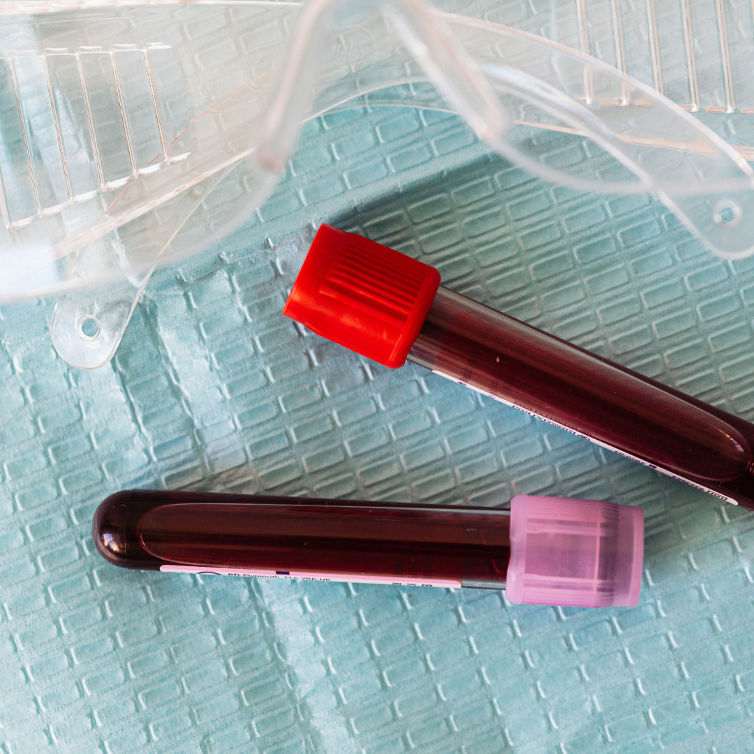 Sangre creada en laboratorio se transfunde por primera vez a personas
