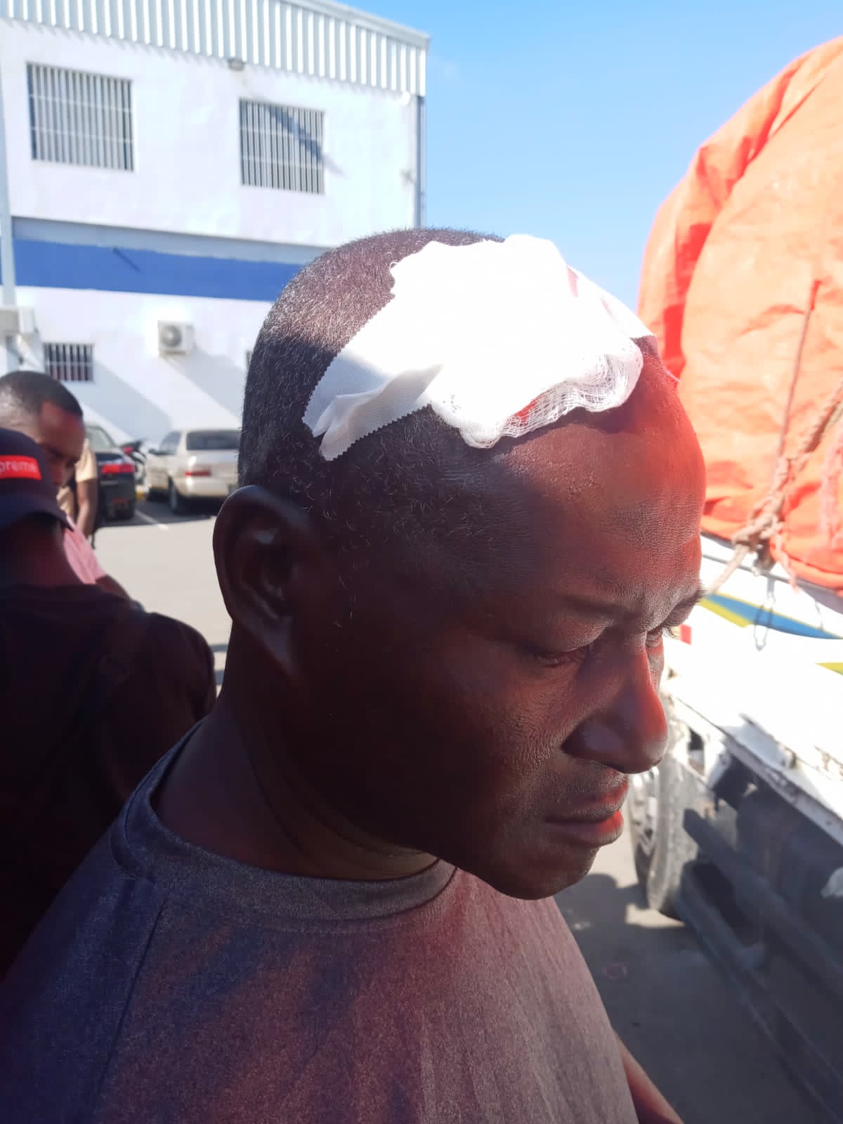 Camionero resulta herido tras haitianos lanzar piedras en puerta fronteriza
