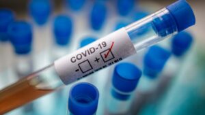 Reportan 271 contagios de Covid-19 en el país