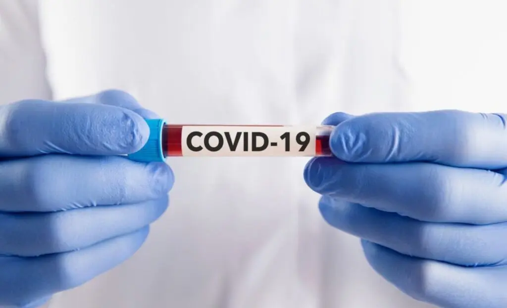 Reportan cinco nuevos casos de Covid-19