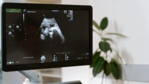 Da miedo: el perturbador rostro de un bebé revelado en un ultrasonido