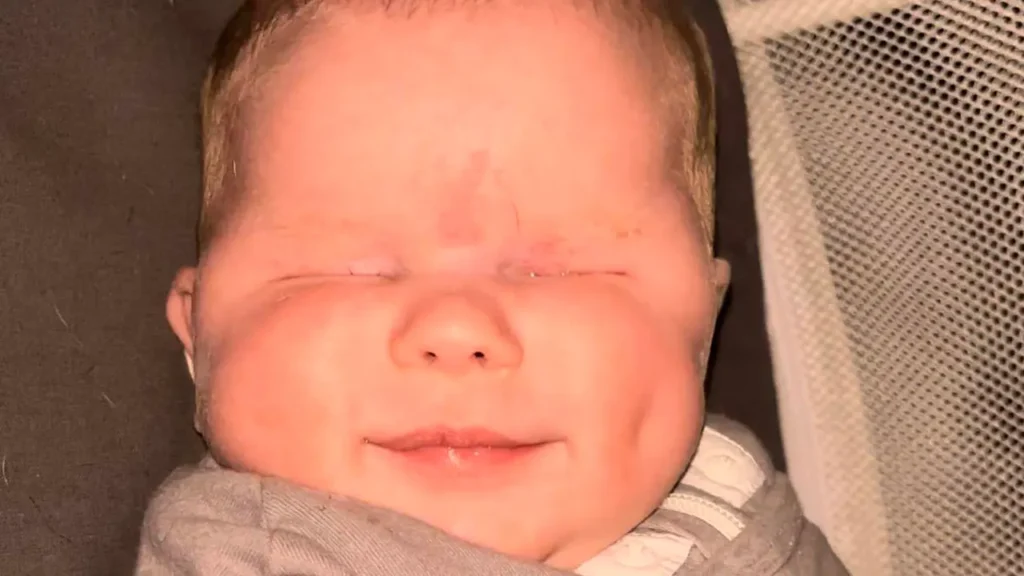 Niña nació sin ojos: uno de los 30 casos en el mundo con esta condición