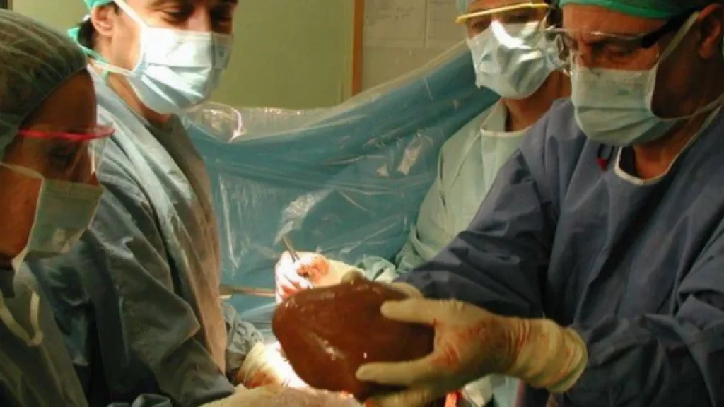 España alcanza un nuevo récord en trasplantes
