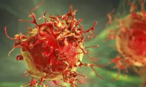 Células cancerosas (Fuente externa)