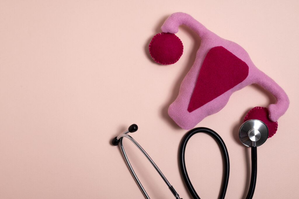 Endometriosis