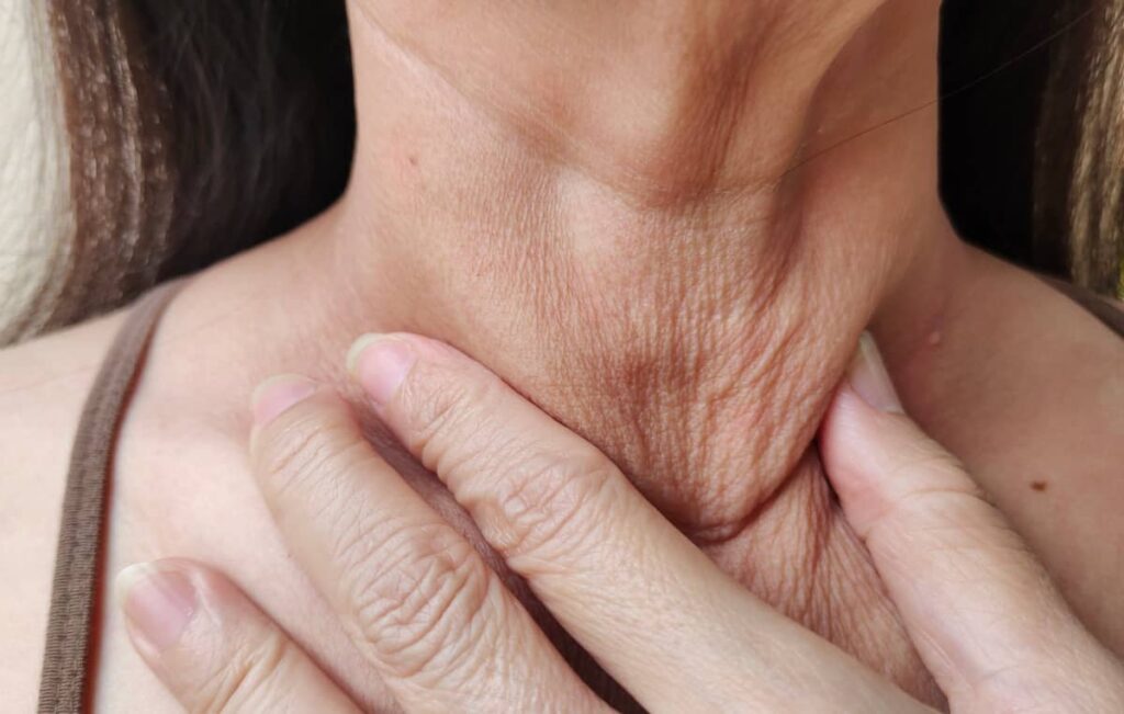 Arrugas en el cuello