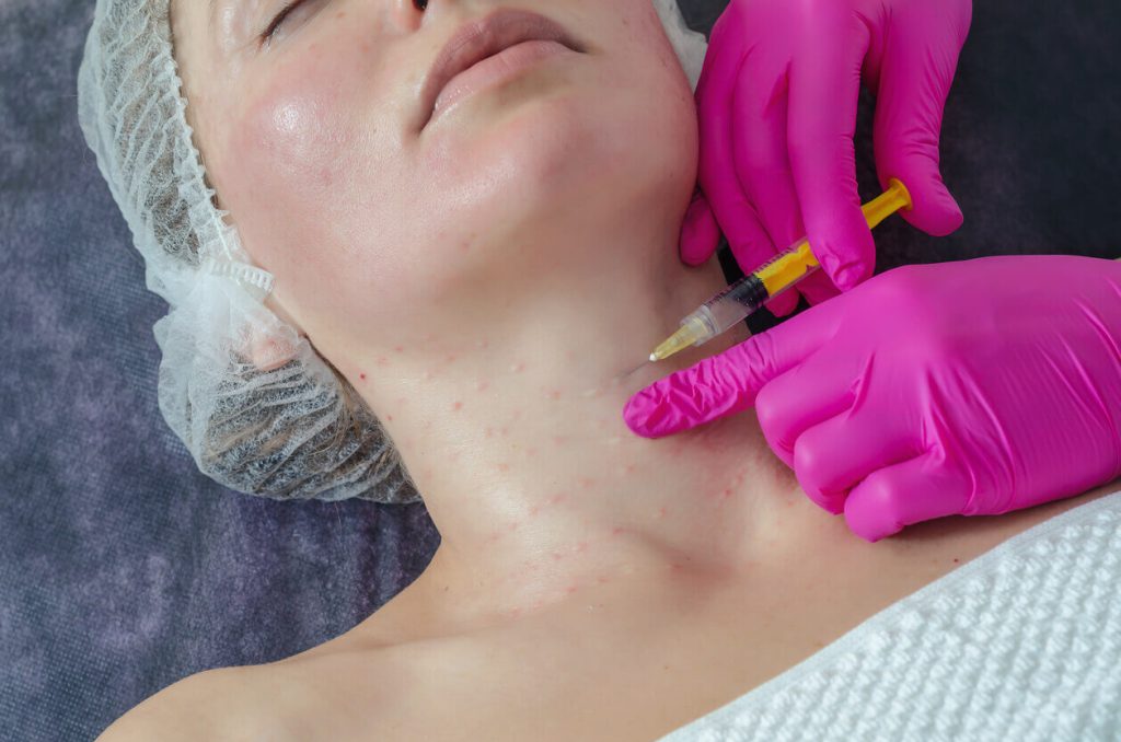 Arrugas en el cuello